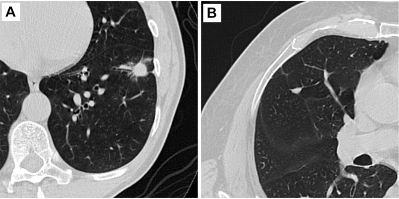 Radiology illustration from clinical paper